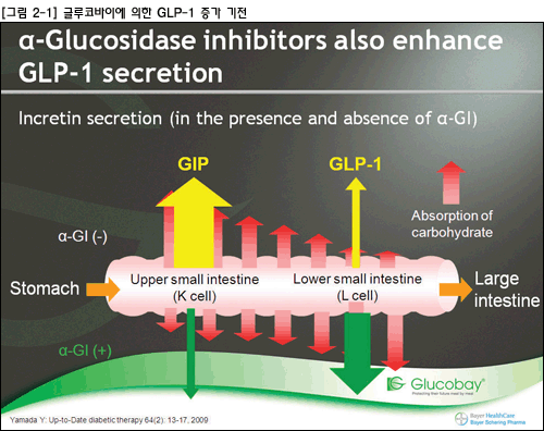 glp-1 gastrointestinal obstruction law office in michigan Ozempic GLP-1 Lawsuit & Gastroparesis