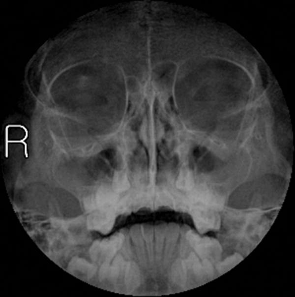 호흡기 감염과 소화기계질환의 Case report