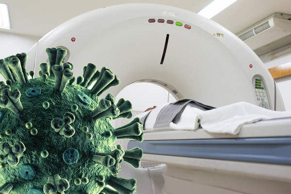 대한흉부영상의학회가 코로나19 환자 522명의 흉부 CT 영상과 흉부 엑스레이 사진을 데이터베이스로 구축했다. 