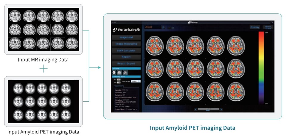 'Veuron-Brain-pAb' 이미지 (출처: 휴런).