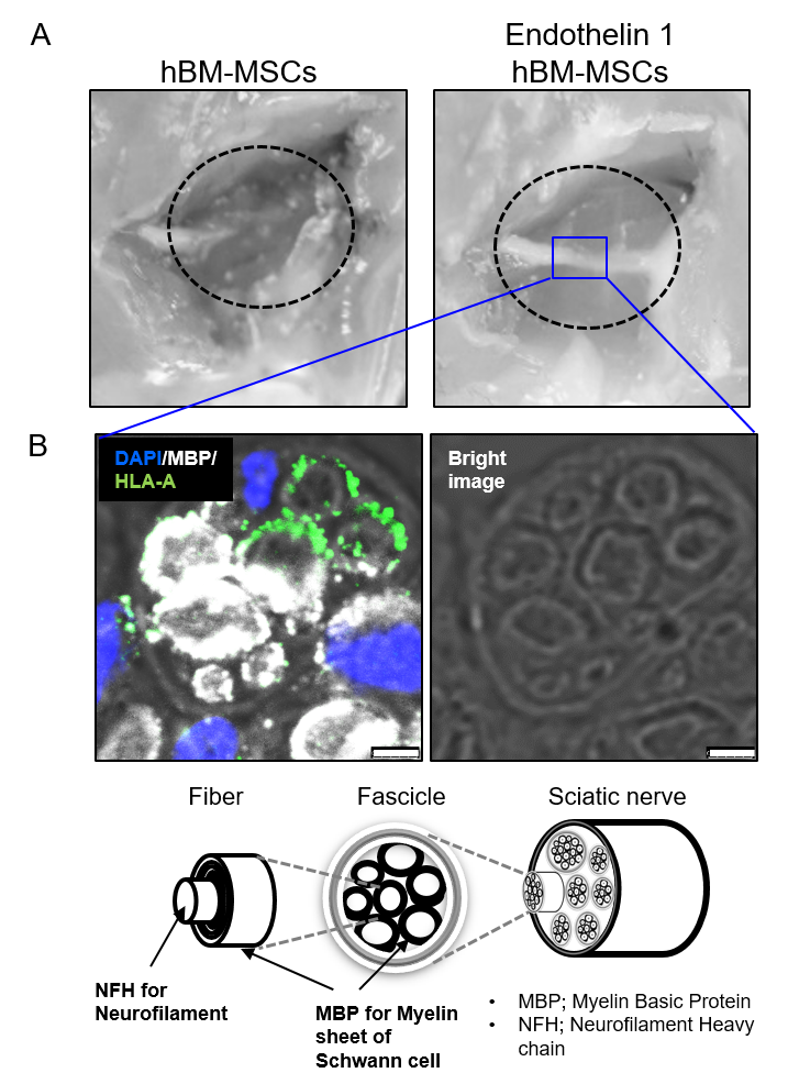 (그림 A) 생쥐 좌골신경 결손모델에서 엔도텔린1을 처리한 인간 중간엽줄기세포(hBM-MSC)를 이식하자 절단된 좌골신경이 재생됐다. (그림 B) 이식한 중간엽줄기세포가 슈반세포로 분화하여 신경 재생을 돕는 것을 나타낸 그림(자료 제공: 서울대병원).