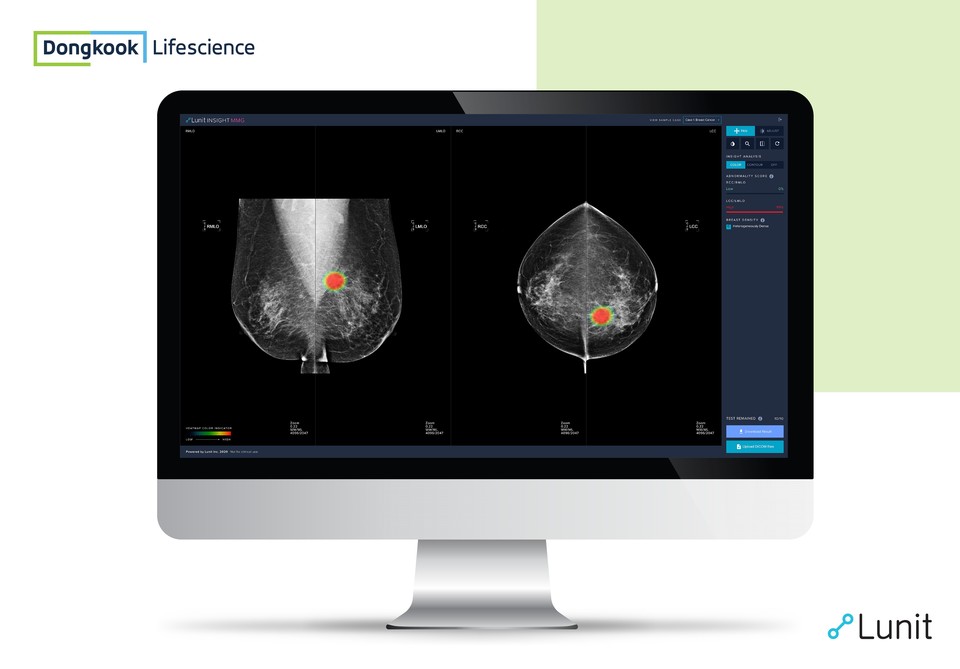 루닛 인사이트 MMG(Lunit INSIGHT MMG).