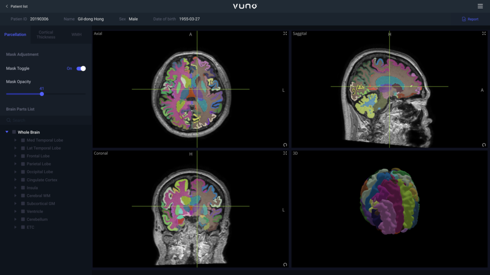 뷰노 AI 기반 3D MRI 촬영 및 판독 의료기기 '뷰노메드 딥브레인' 관련 이미지.
