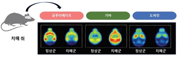 The part where the radiopharmaceutical has been absorbed is shown in red.  For glutamate and dopamine, the absorption rate of radiopharmaceuticals was lower in the dementia group than in the normal group, and the absorption rate of radiopharmaceuticals in the dementia group was higher in the dementia group than in the normal group.