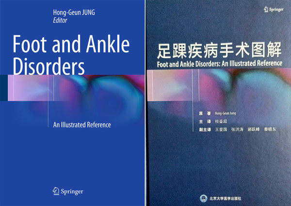 지난 2016년 스프링거에서 나온 ‘Foot and Ankle Disorders’(왼쪽)와 올해 8월 중국에서 출간된 중국어 번역판(사진제공: 건국대병원).
