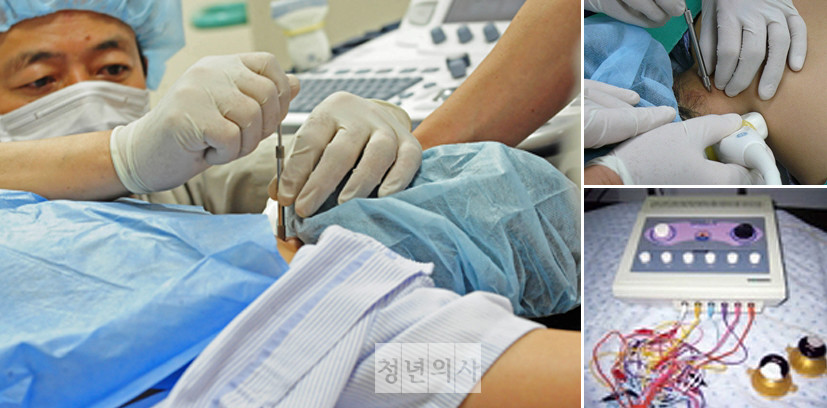 “법원이 IMS를 한방 침술행위로 인정? 사실 왜곡”_청년의사