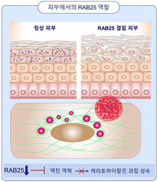 아토피 피부염 약물 개발 실마리 찾았다