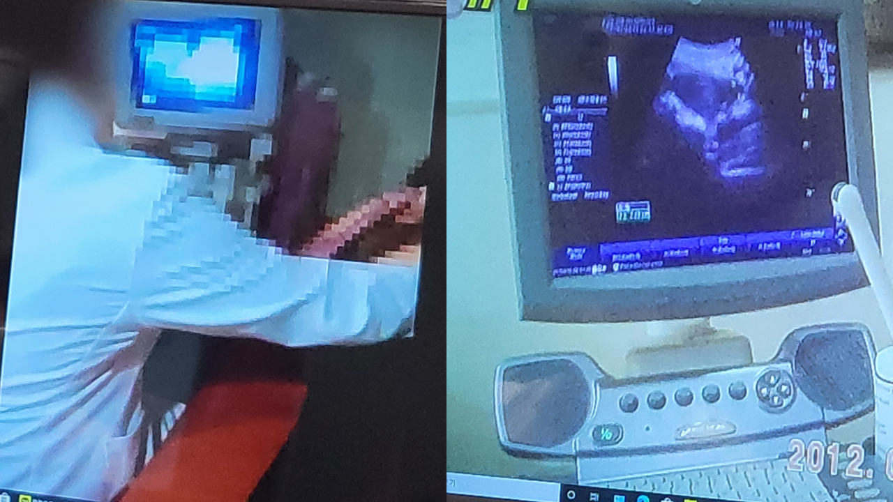 대한의사협회는 22일 한의사 초음파 사용 영상을 공개하고 대법원 전원합의체가 환자 위해를 간과했다고 비판했다(ⓒ청년의사).