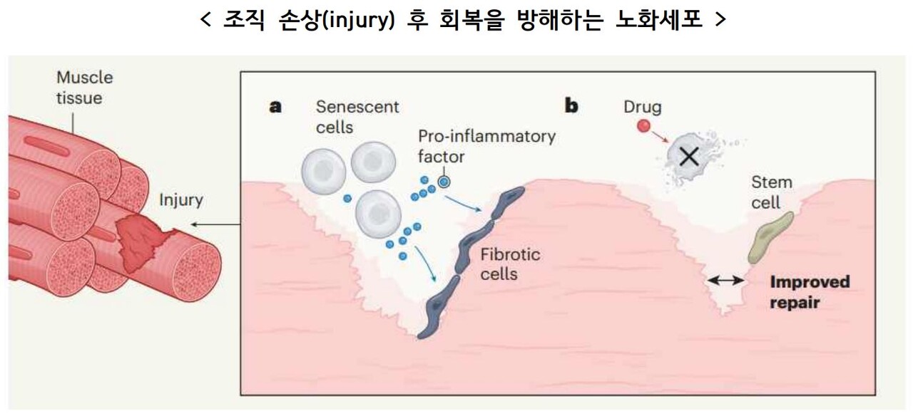 노화세포 특성 발견…노화방지 연구 가속도 붙나