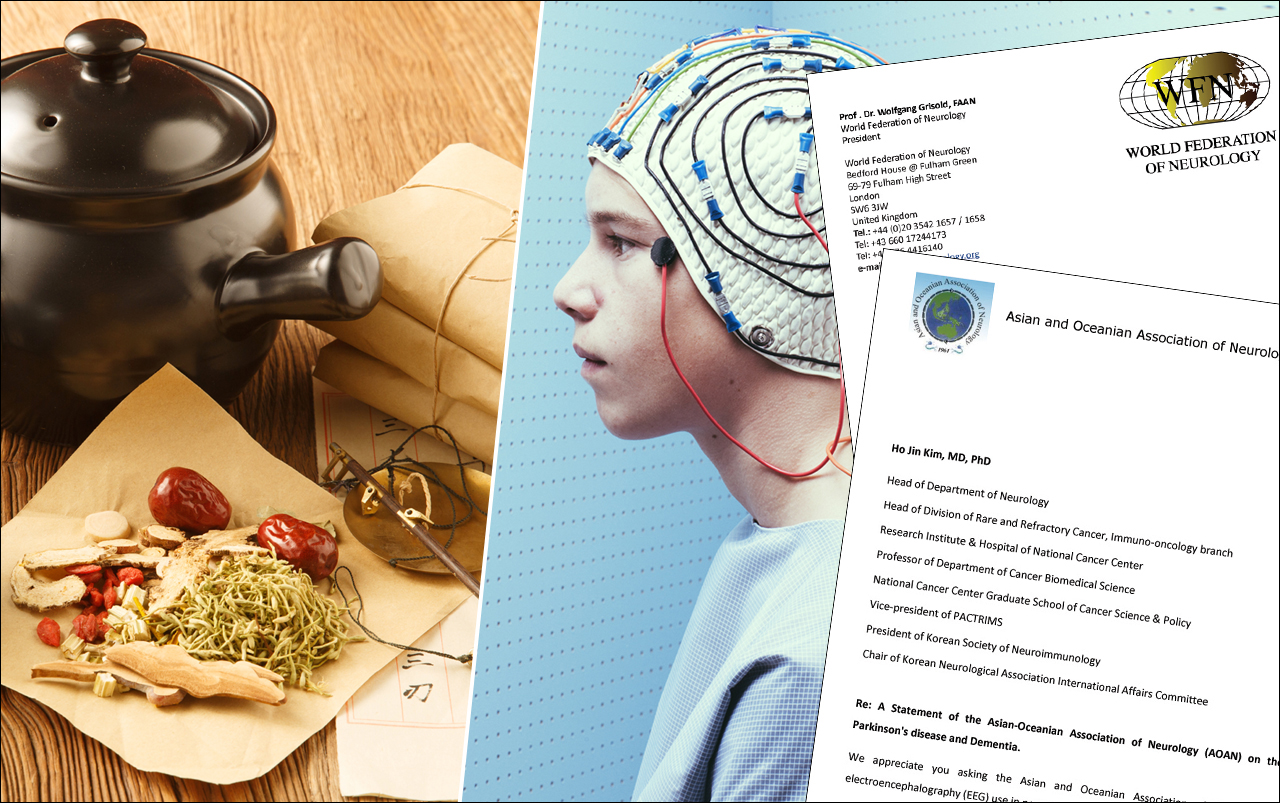 아시아·오세아니아신경과학회(AOAN), 세계신경학연맹(WFN), 국제파킨슨병및이상운동질환학회(MDS)는 뇌파검사로 파킨슨병과 치매를 진단할 수 없으며 뇌파검사 자체를 전문성을 갖춘 신경과 전문의가 수행해야 한다고 강조했다(ⓒ청년의사).