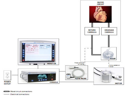 애보트메디칼코리아의 소아용 의료용보조순환장치 ‘CentriMag system-PediVAS’ 전체 시스템.