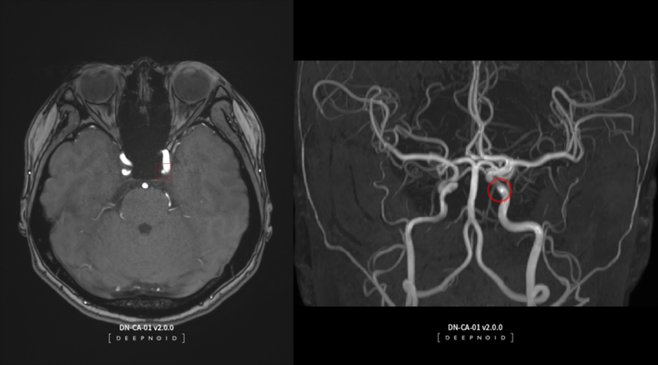딥노이드 딥뉴로