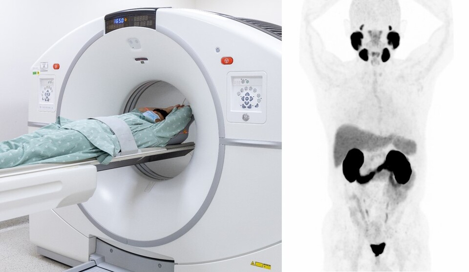 이대서울병원이 전립선암 환자를 위한 ‘Ga-68 PSMA PET CT 검사’를 도입했다(사진제공: 