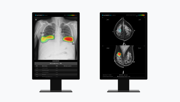 루닛 흉부 엑스레이 AI 영상분석 솔루션 '루닛 인사이트 CXR'(왼쪽) 및 유방촬영술 AI 영상분석 솔루션 ' 루닛 인사이트 MMG' (사진제공: 루닛)