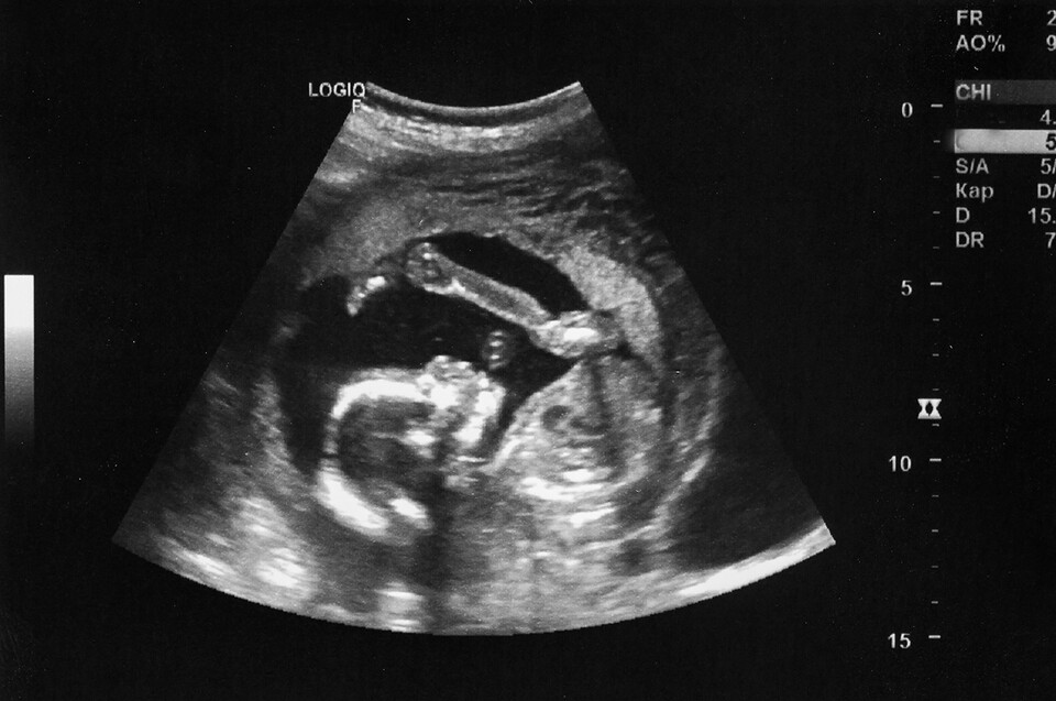 서울시의사회는 16일 임신 36주 차에 낙태 수술을 받았다는 유튜브 영상에 대해 철저한 수사를 촉구했다(사진출처: 게티이미지).