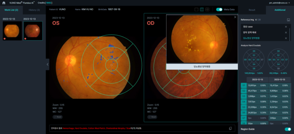 뷰노메드 펀더스 AI 운영화면 예시 (사진제공: 뷰노)