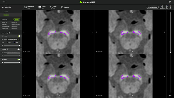 휴런NM 관련 이미지(제공: 휴런).