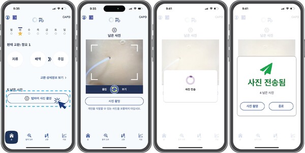 앞으로 복막투석 환자가 마이피디 앱을 통해 자신의 치료 사진을 의료진에게 전송할 수 있다. (사진 제공: 박스터)