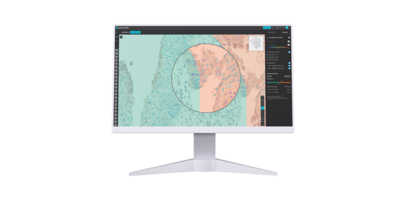 루닛 AI 기반 면역조직염색(IHC) 분석 솔루션 ‘루닛 스코프 uIHC’(제공: 루닛).