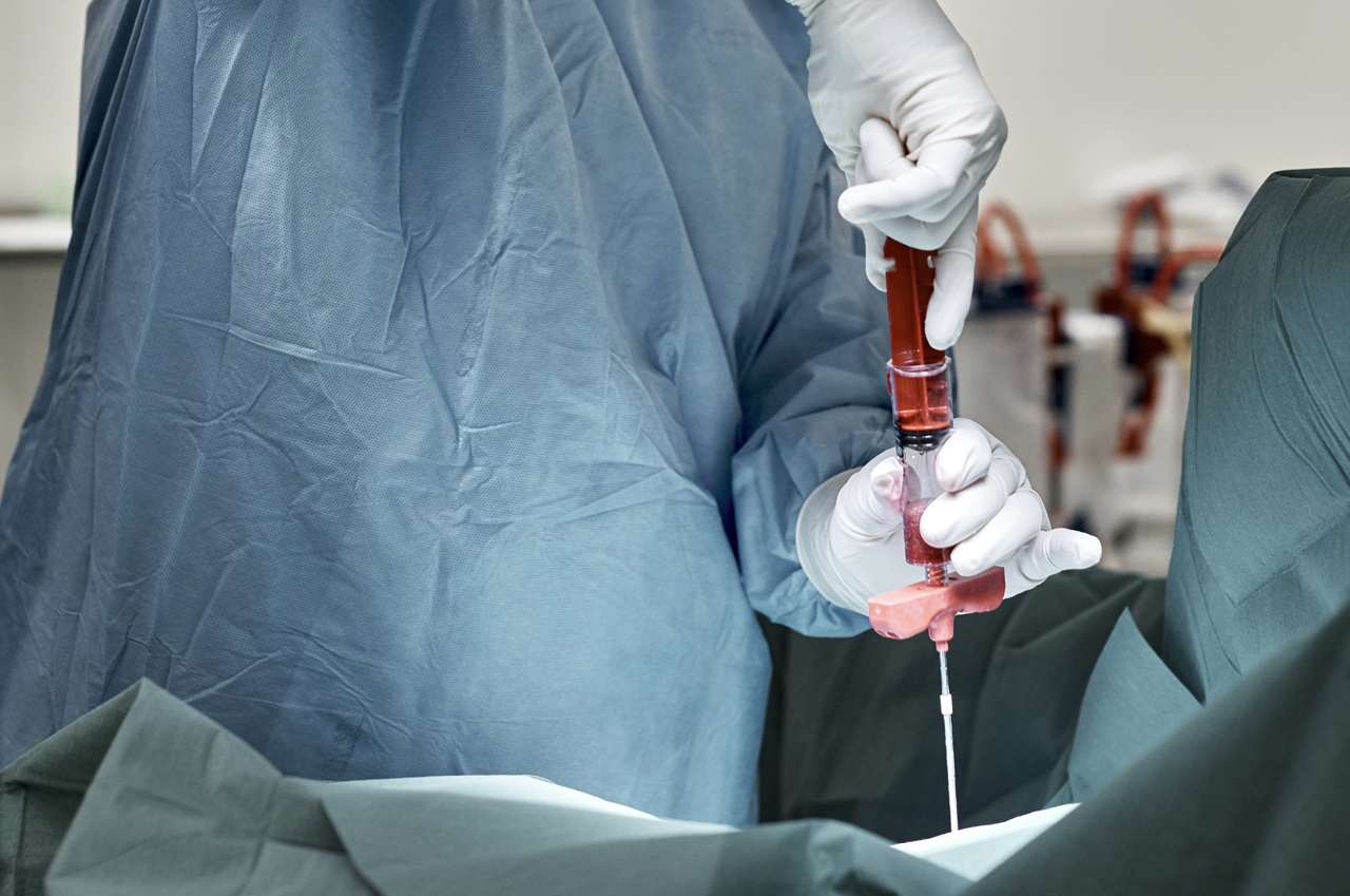 한국백혈병환우회가 골수검사를 받은 적이 있는 환자 354명을 대상으로 설문조사를 진행한 결과, 61%가 골수검사를 의사만이 할 수 있는 행위로 인식하고 있다고 답했다(사진출처: 게티이미지).