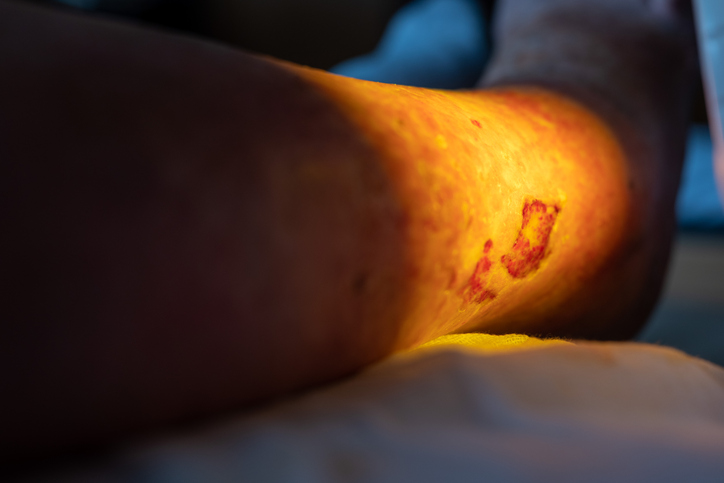 (이미지 출처: 게티이미지).