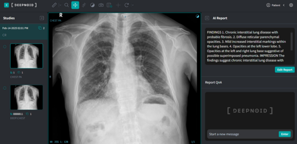 M4CXR 이미지(딥노이드 제공).