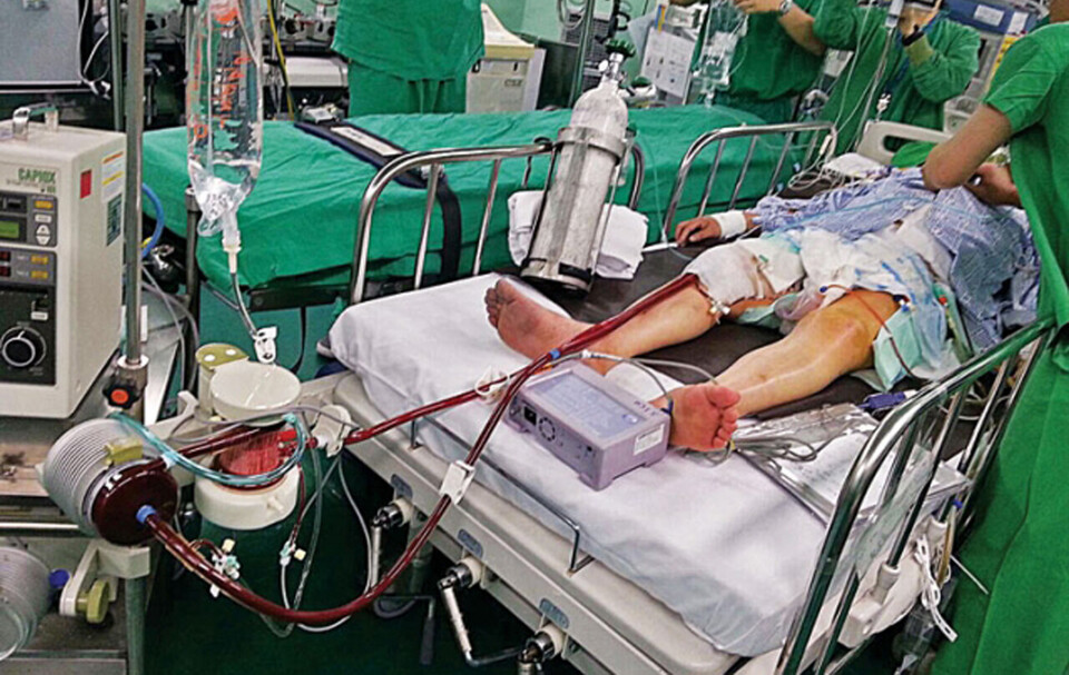 하위법령으로 간호법을 보완하지 않으면 의료기사뿐 아니라 간호사 출신 체외순환사도 불법이 될 수 있다는 지적이다. 이렇게 되면 심장 수술도 멈출 수 있다는 위기 의식이 커지고 있다(ⓒ청년의사).