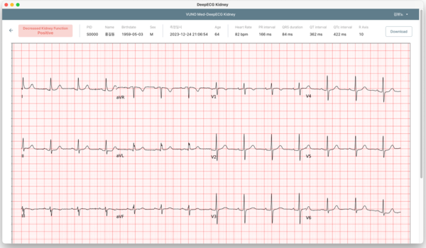 DeepECG Kidney 운영화면 예시.
