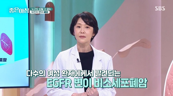 “비흡연 여성도 폐암 위험…정기검진 통한 조기 진단 중요"