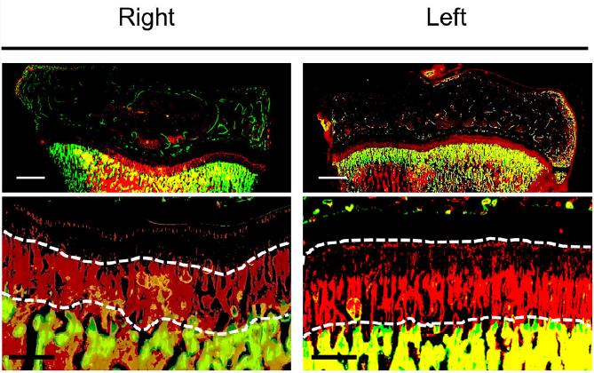 해운대백병원 소아정형외과 박병규 교수와 세브란스 어린이병원 소아정형외과 박건보 교수 연구팀이 분석한 토기 정강이뼈 사진(사진제공: 해운대백병원).