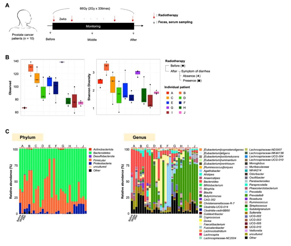 전립선암 환자 방사선 치료 도식(사진제공: 해운대백병원).