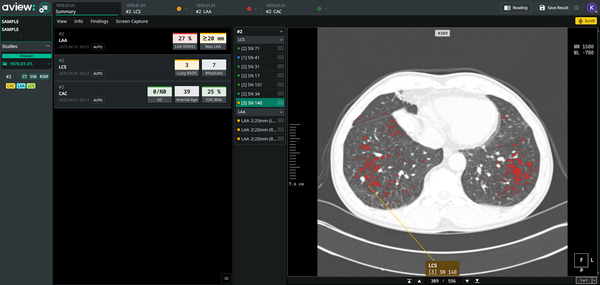 코어라인소프트는 미국 뉴저지주에서 23개의 외래 영상의학센터를 운영하는 ImageCare Radiology와 AI 흉부질환 동시분석 플랫폼 AVIEW LCS Plus 공급 계약을 체결했다.(사진제공: 코어라인소프트)