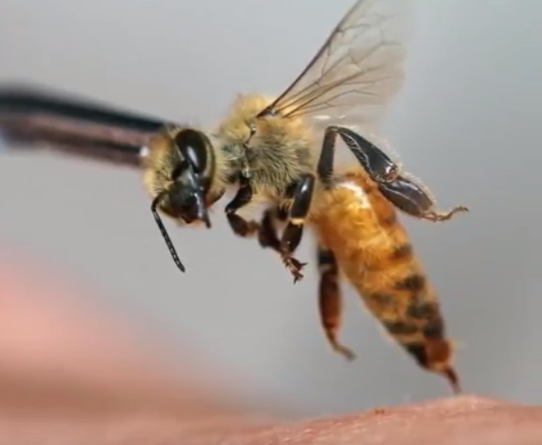 Skin-rejuvenating bee acupuncture may prove deadly