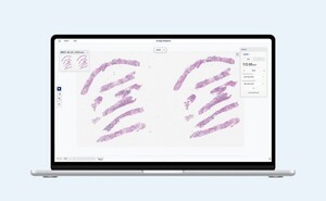 엠티에스컴퍼니, 디지털 병리 AI 'Ai-Alpa Mitosis' 공개 - 뉴스 썸네일 이미지